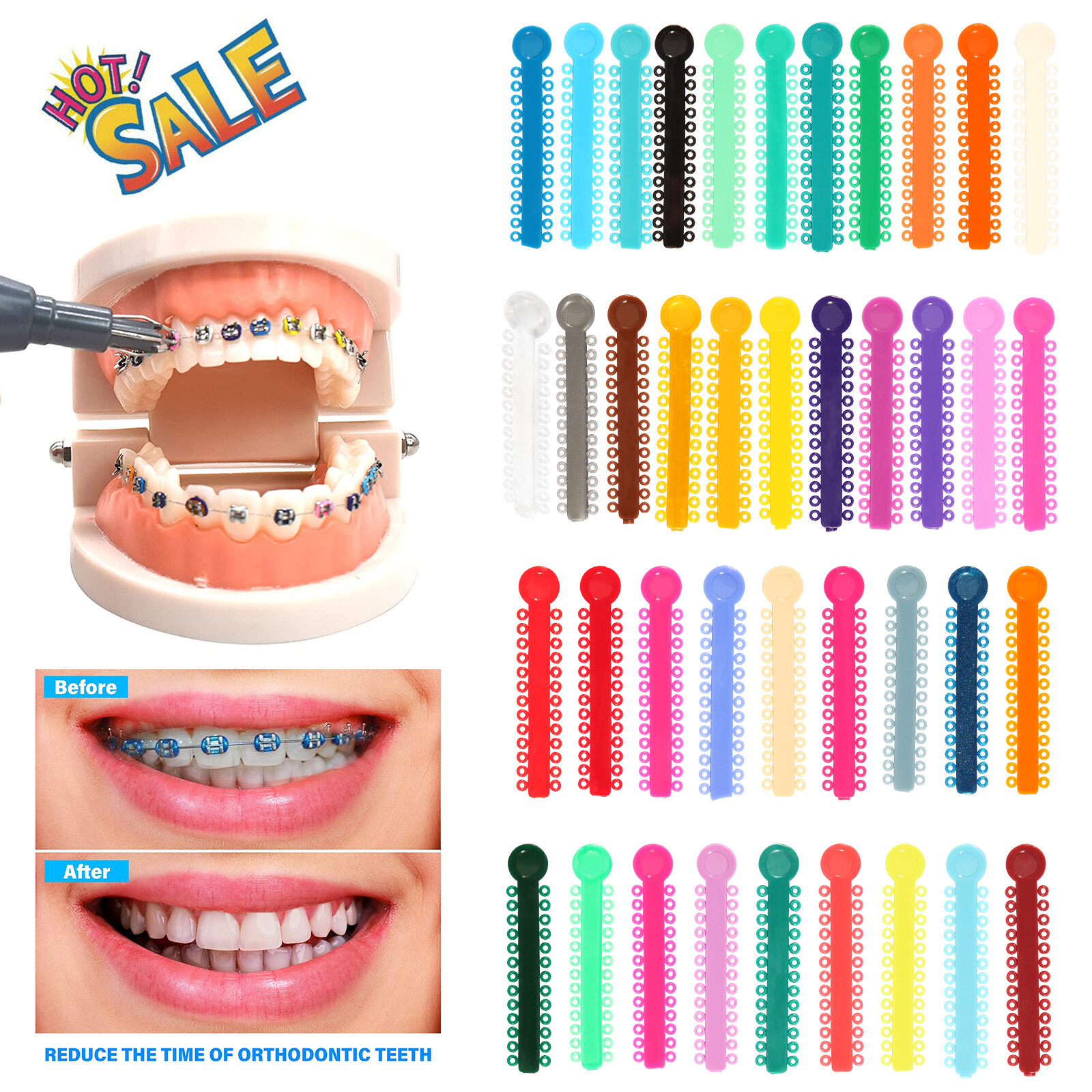 1040pcs Dental Orthodontic Ligature Ties Elastic Bands for Brackets 43 Colors AA